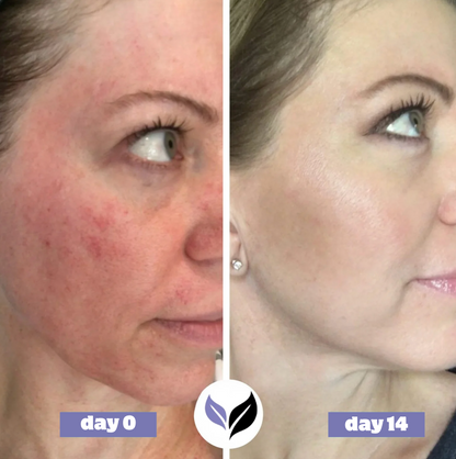 Saentity - Haua Korean Skin Care